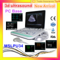 New arrival, upgraded 3D ultrasound machine MSLPU34